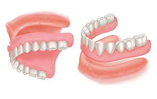 Complete Dentures 2